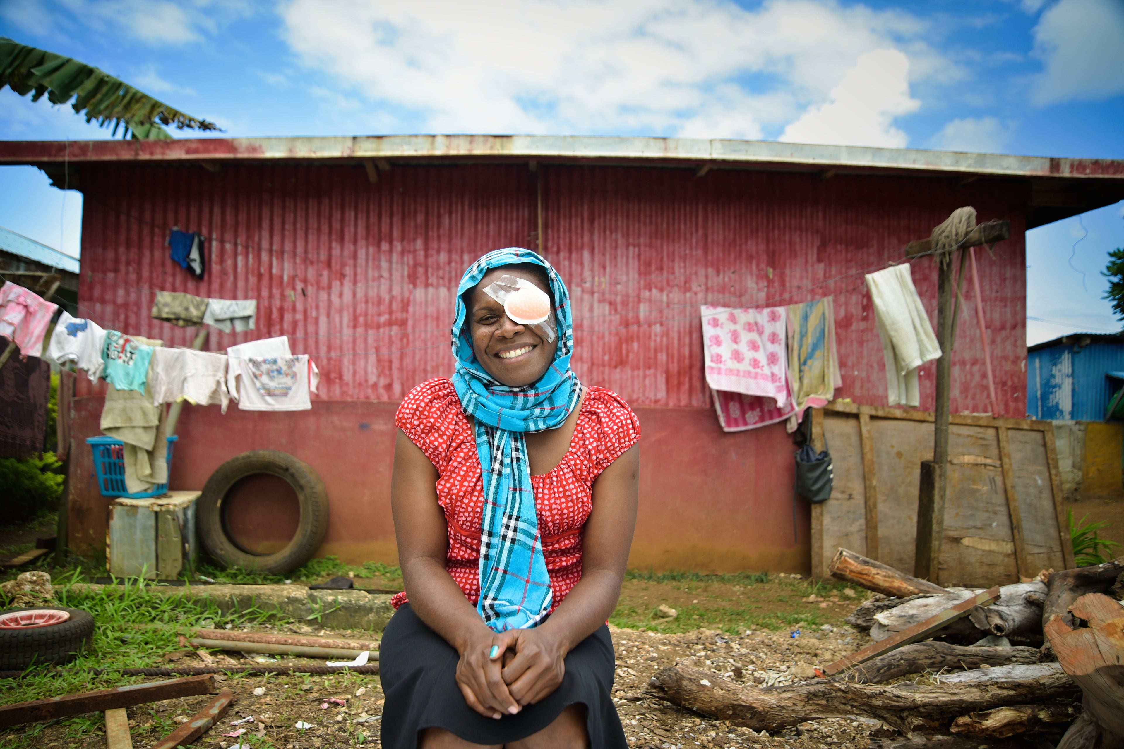 Pacific Island woman with eye patch smiling after curing blindness and restoring eye sight.